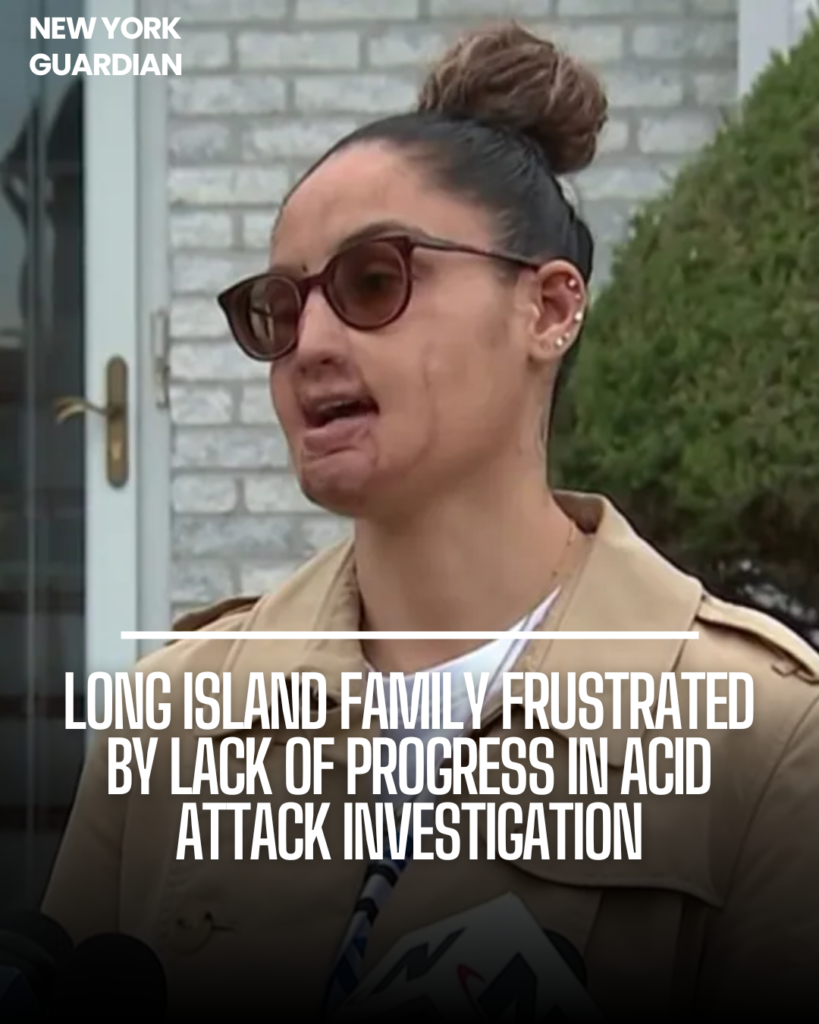 A Long Island family is frustrated with the police investigation into a 2021 acid attack case.